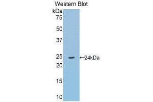Western Blotting (WB) image for anti-Angiotensinogen (serpin Peptidase Inhibitor, Clade A, Member 8) (AGT) (AA 155-355) antibody (ABIN1857946)