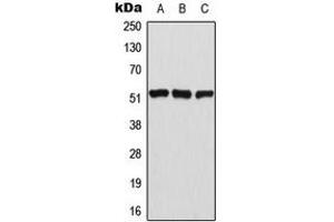 Western blot analysis of ATF2 (pT69) expression in HeLa (A), NIH3T3 (B), PC12 (C) whole cell lysates. (ATF2 anticorps  (N-Term, pSer69))