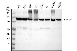 Western blot analysis of NAT10 using anti-NAT10 antibody (ABIN7605662).