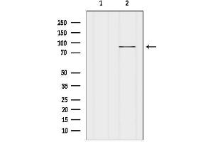 Western blot analysis of lysates from Mouse spleen, using FAK Antibody.