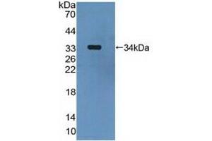 Detection of Recombinant MAP2K6, Human using Polyclonal Antibody to Mitogen Activated Protein Kinase Kinase 6 (MAP2K6) (MAP2K6 anticorps  (AA 46-306))