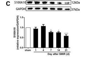 Astrocytes were activated and mainly expressed as the A1 phenotype in the spinal cord after SMIR. (GAPDH anticorps)
