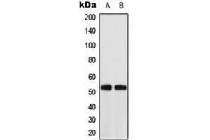 Western blot analysis of ACOT2 expression in K562 (A), HT29 (B) whole cell lysates.