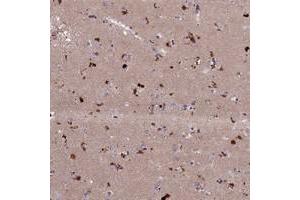 Immunohistochemical staining of human lateral ventricle with ADO polyclonal antibody  shows strong cytoplasmic positivity in neuronal cells.