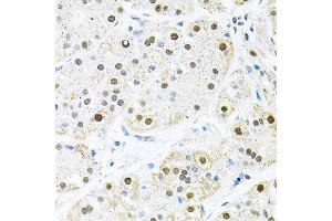 Immunohistochemistry of paraffin-embedded human stomach using BCCIP antibody at dilution of 1:100 (x40 lens).