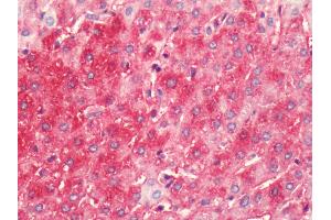Human, Liver: Formalin-Fixed Paraffin-Embedded (FFPE) (HRH4 anticorps  (C-Term))