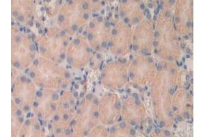 Detection of LAMa4 in Mouse Kidney Tissue using Polyclonal Antibody to Laminin Alpha 4 (LAMa4)