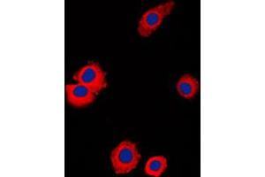 Immunofluorescent analysis of NBL1 staining in Raw264. (NBL1 anticorps  (C-Term))