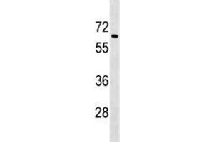 Tgfbr2 antibody western blot analysis in mouse spleen tissue lysate.