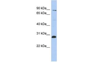 WB Suggested Anti-ZNF148 Antibody Titration:  0.