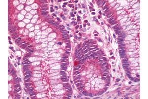 Anti-VTCN1 / B7-H4 antibody IHC staining of human colon.