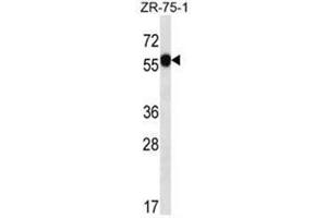 C6orf211 Antibody (N-term) western blot analysis in ZR-75-1 cell line lysates (35µg/lane). (C6ORF211 anticorps  (N-Term))