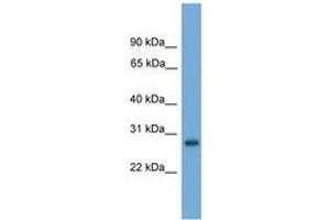 Image no. 1 for anti-Activator of Basal Transcription 1 (Abt1) (AA 171-220) antibody (ABIN6744581) (Activator of Basal Transcription 1 anticorps  (AA 171-220))