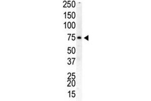 Western blot analysis of PIP5K1B antibody and human placenta cell lysate