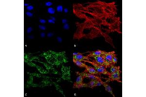 Immunocytochemistry/Immunofluorescence analysis using Rabbit Anti-VMP1 Polyclonal Antibody . (VMP1 anticorps  (AA 391-402) (PE))