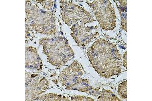 Immunohistochemistry of paraffin-embedded human stomach using CPOX antibody. (CPOX anticorps  (AA 111-454))