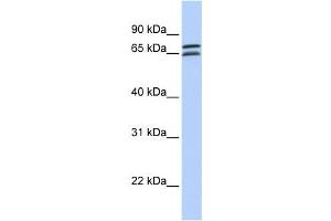 Western Blotting (WB) image for anti-DCP1 Decapping Enzyme Homolog B (DCP1B) antibody (ABIN2459448) (DCP1B anticorps)