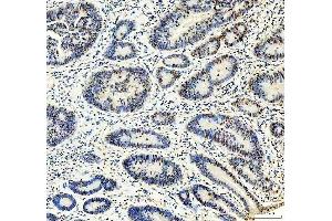 IHC analysis of MTA2 using anti-MTA2 antibody (ABIN7599519). (MTA2 anticorps  (AA 1-668))
