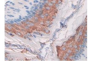 Detection of MST1R in Mouse Stomach Tissue using Polyclonal Antibody to Macrophage Stimulating 1 Receptor (MST1R)