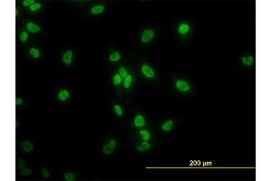 Immunofluorescence of monoclonal antibody to TAF11 on HeLa cell. (TAF11 anticorps  (AA 158-210))