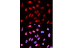 Immunofluorescence analysis of U2OS cells using RFC4 antibody. (RFC4 anticorps  (AA 204-363))