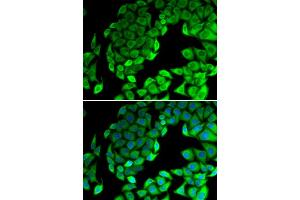 Immunofluorescence analysis of MCF7 cell using RPL14 antibody. (RPL14 anticorps)