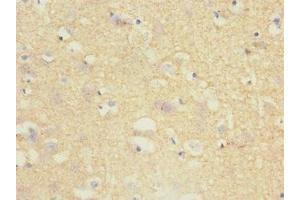 Immunohistochemistry of paraffin-embedded human brain tissue using ABIN7173721 at dilution of 1:100 (Tppp anticorps  (AA 1-219))