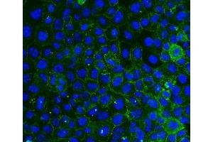 IF analysis of ITGB4 using anti-ITGB4 antibody (ABIN7601134). (Integrin beta 4 anticorps  (AA 29-431))