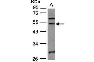 WB Image Sample(30 ug whole cell lysate) A:293T 10% SDS PAGE antibody diluted at 1:1000 (NSUN6 anticorps  (Center))