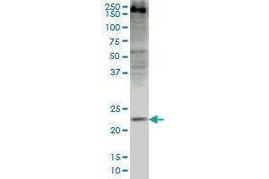 CRYGD monoclonal antibody (M03), clone 4E12 Western Blot analysis of CRYGD expression in HepG2 . (CRYGD anticorps  (AA 75-174))