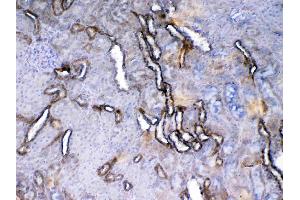IHC analysis of VEGF Receptor 2 using anti-VEGF Receptor 2 antibody .