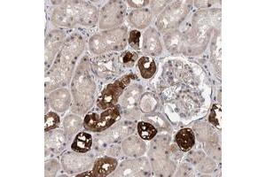 Immunohistochemical staining of human kidney with SLC45A4 polyclonal antibody  shows strong cytoplasmic positivity in subsets of renal tubules.