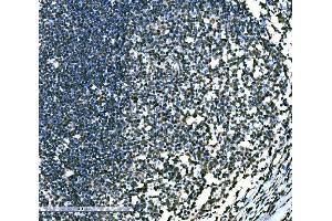 IHC analysis of SnoN/SNO/SKIL using anti-SnoN/SNO/SKIL antibody (ABIN7599455). (SKIL anticorps  (AA 1-504))