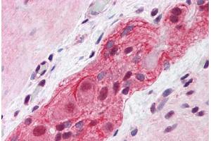 anti-Mediator Complex Subunit 17 (MED17) (AA 551-652) antibody