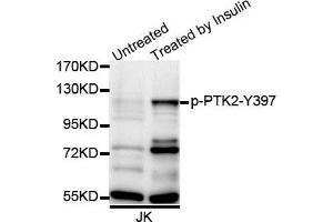 Western blot analysis of extracts of Jurkat cell line, using Phospho-PTK2-Y397 antibody. (FAK anticorps  (pTyr397))