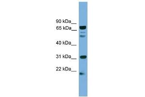 WB Suggested Anti-SLC6A3 Antibody Titration:  0.