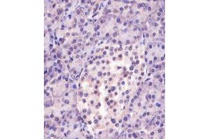 (ABIN6244040 and ABIN6578881) staining MGEA5 in human pancreas tissue sections by Immunohistochemistry (IHC-P - paraformaldehyde-fixed, paraffin-embedded sections).