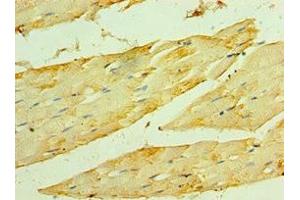 Immunohistochemistry of paraffin-embedded human skeletal muscle tissue using ABIN7154911 at dilution of 1:100