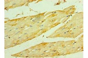 Immunohistochemistry of paraffin-embedded human skeletal muscle tissue using ABIN7154911 at dilution of 1:100 (HSPB2 anticorps  (AA 1-182))