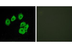 Peptide - +Western blot analysis of extracts from COS7 cells, using CLTR1 antibody. (CysLTR1 anticorps  (Internal Region))