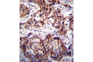 Immunohistochemistry (IHC) image for anti-Discoidin Domain Receptor tyrosine Kinase 1 (DDR1) antibody (ABIN3003119) (DDR1 anticorps)