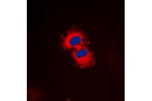 Immunofluorescent analysis of ZAK staining in HeLa cells.