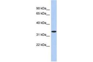 Image no. 1 for anti-Aspartoacylase (ASPA) (AA 71-120) antibody (ABIN6743962) (ASPA anticorps  (AA 71-120))