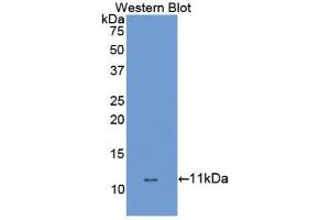 Western blot analysis of the recombinant protein. (SLC6A3 anticorps  (AA 562-619))