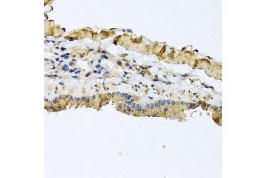 Immunohistochemistry of paraffin-embedded mouse lung using ATP2C1 antibody (ABIN5975353) at dilution of 1/100 (40x lens). (ATP2C1 anticorps)