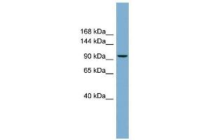 PPP1R3A antibody used at 1 ug/ml to detect target protein. (PPP1R3A anticorps)