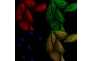 ABIN6264833 and ABIN6279044 staining  cells by IF/ICC. (RPL29 anticorps  (Internal Region))