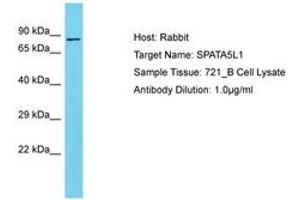 Image no. 1 for anti-Spermatogenesis Associated 5-Like 1 (SPATA5L1) (AA 580-629) antibody (ABIN6750664) (SPATA5L1 anticorps  (AA 580-629))