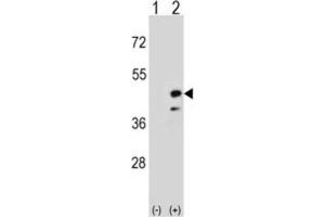 Western Blotting (WB) image for anti-Creatine Kinase, Mitochondrial 2 (Sarcomeric) (CKMT2) antibody (ABIN3002971) (CKMT2 anticorps)