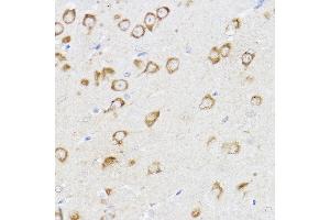 Immunohistochemistry of paraffin-embedded mouse brain using MCL1 Rabbit pAb (ABIN3020787, ABIN3020788, ABIN3020789 and ABIN6213724) at dilution of 1:100 (40x lens). (MCL-1 anticorps  (AA 120-220))